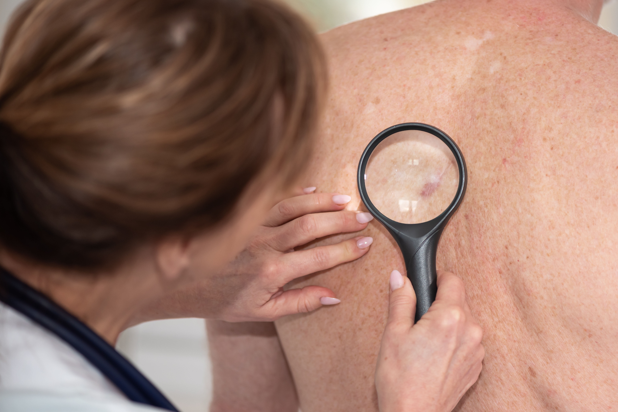 Dermatologija Ljubljana mi je spremenila odnos do sebe
