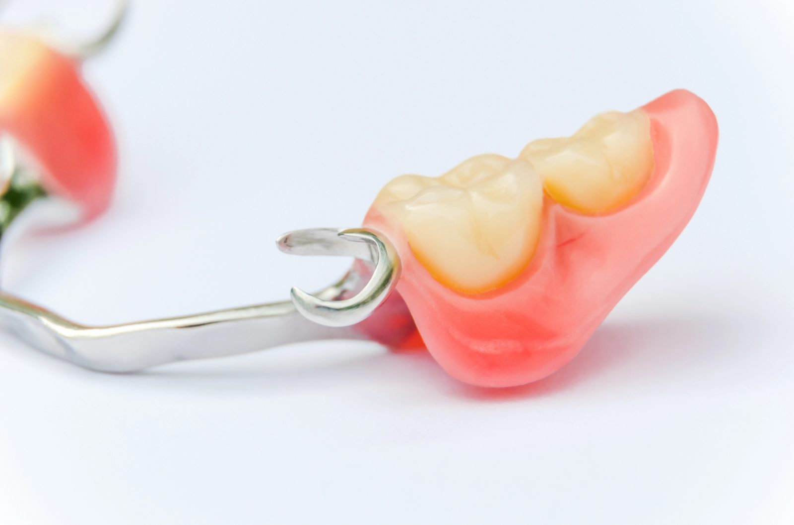 Rešitev za manjkajoče zobe so zobne proteze različnih vrst